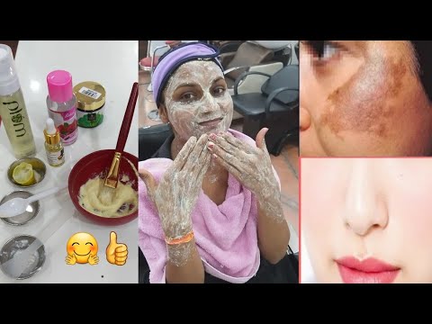 DIY skin care how to remove (pigmentation) uneven skin and pimples