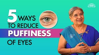 Home Remedies for Puffy Eyes I Treat puffy eyes naturally I Dr. Hansaji