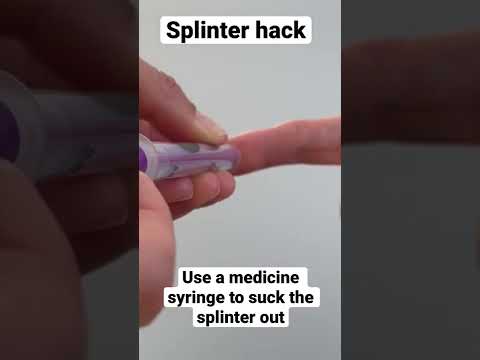How to remove a splinter #shorts #splinter #splinterhack
