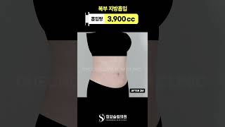 복부 라인… 2개월만에 이렇게 정리됨? 🫢💗