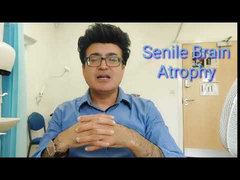 Senile Brain Atrophy on CT images