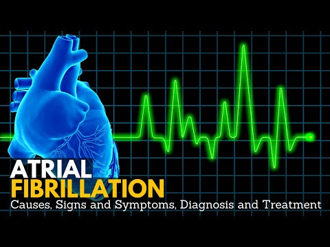 Myocardial Infarction Causes Signs and Symptoms Diagnosis and Treatment