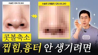 콧볼 축소 할까말까?! 진짜,, 후회하기 싫으면 꼭 보세요! | 코슐랭tv 비더뉴