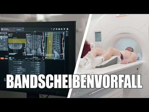 Diagnose: Bandscheibenvorfall (die bittere Wahrheit)