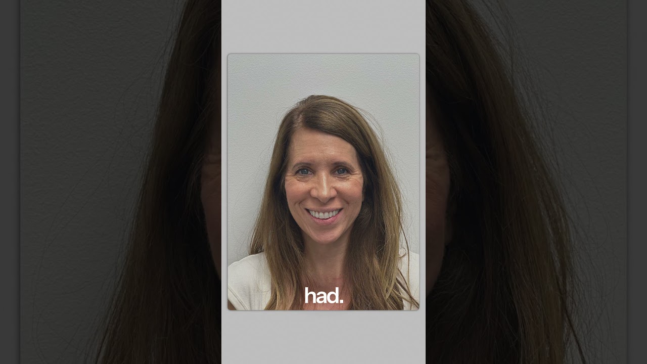 Solace Dental - Invisalign Testimonial Karrie S.