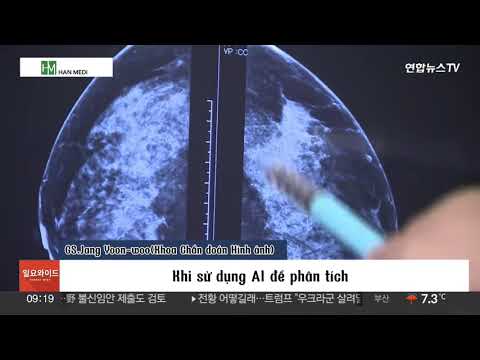 Ung thư vú – nỗi ám ảnh của phụ nữ