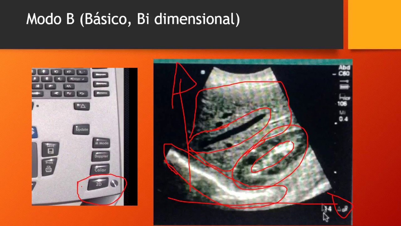 Simplificando o Uso do Ultrassom   Ajustes de Imagem