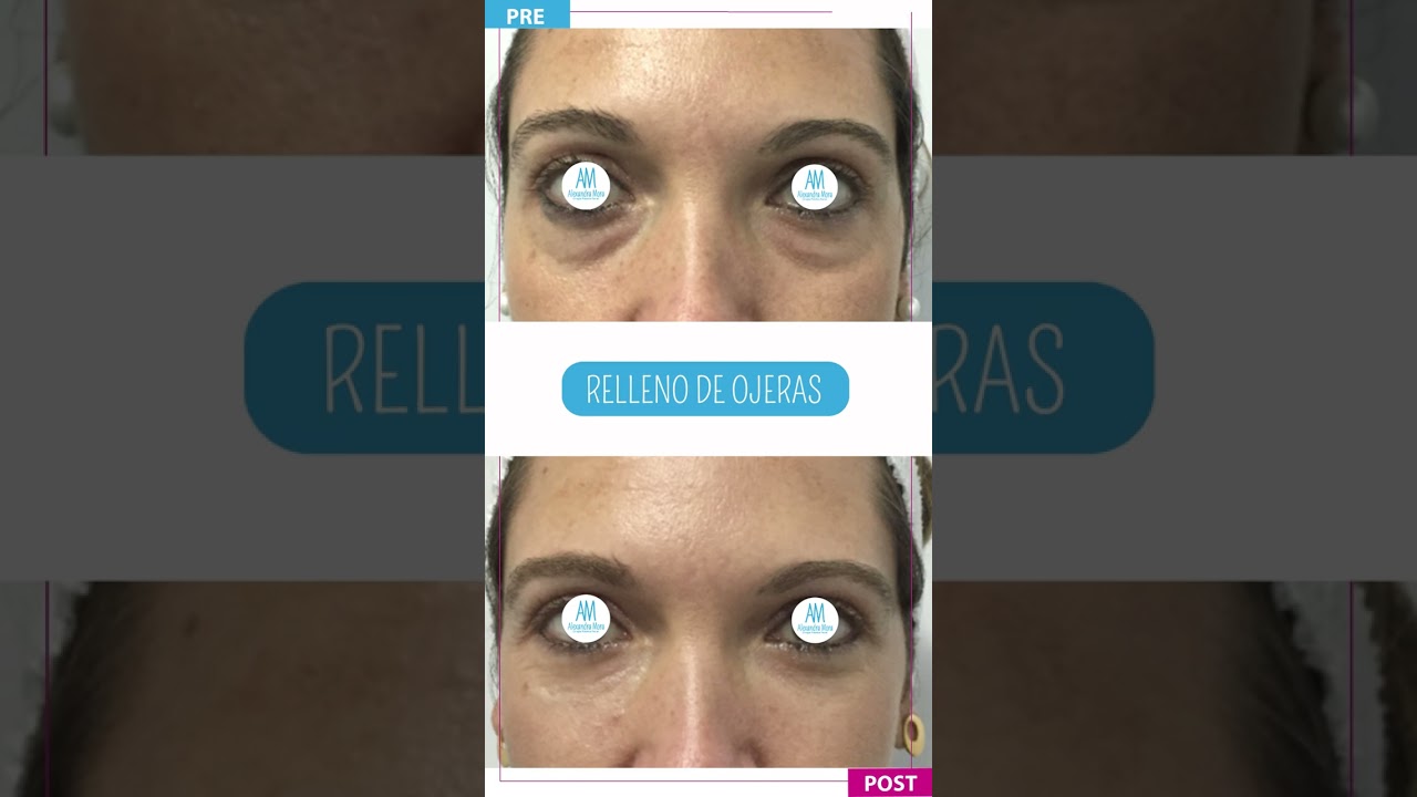 Alexandra Mora Hernandez-111