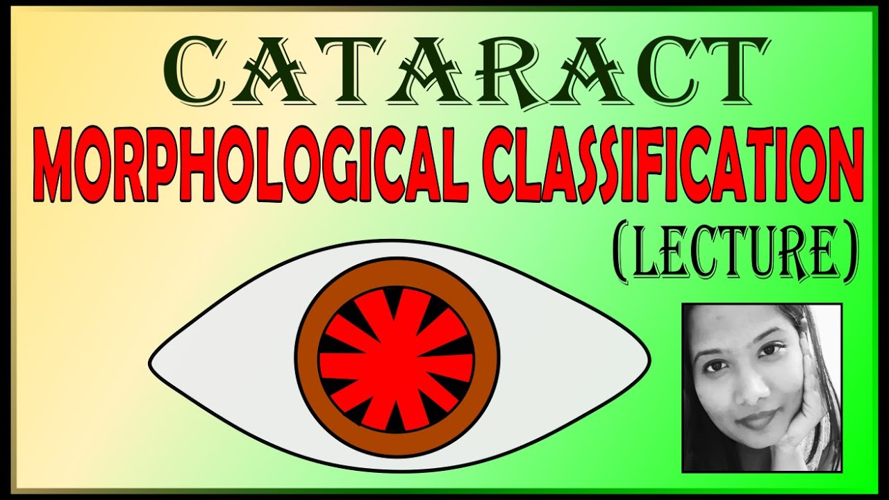 Morphological Classification of Cataract | Different Types of Cataract | Ophthalmology Lectures