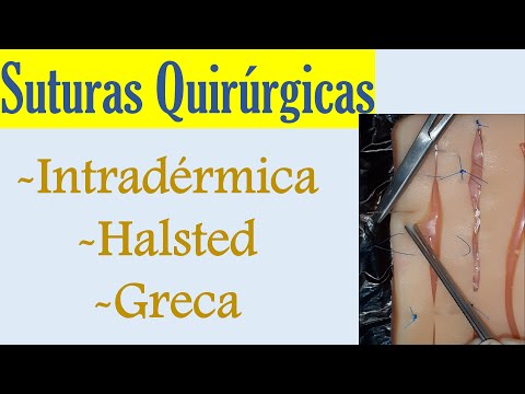 SUTURAS: INTRADÉRMICA, HALSTED Y GRECA