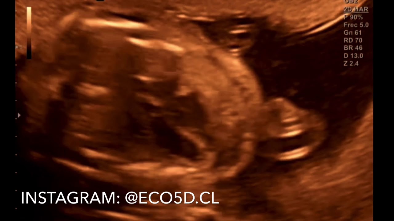 Benjamín Villarroel Castillo-18