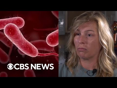 Survivor of flesh-eating bacteria speaks out: "Just thankful to be here"