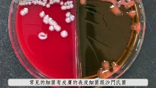 感染性血管瘤補片手術│黃暄喬醫師