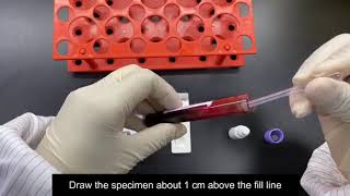 How to perform ALLTEST rapid Coronavirus test kit