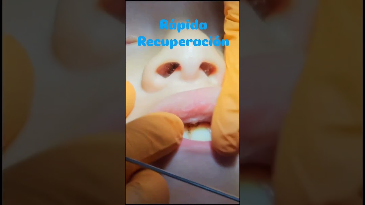 Ángel De Jesús Rios Callejas-20