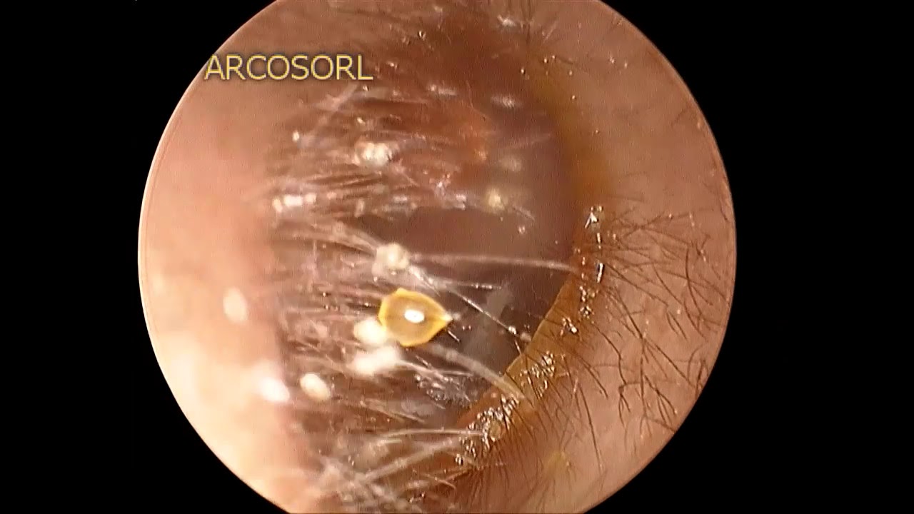 Arnulfo Cornejo Suárez-3