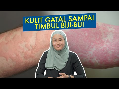 Kulit Gatal Sampai Timbul Biji-Biji