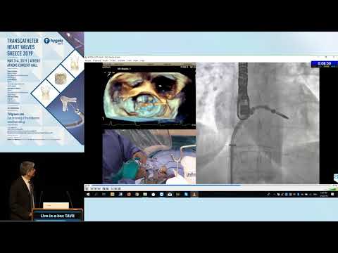 M. Chrissoheris | Live in a Box | TAVI Session III – TAVR dilemmas and complications