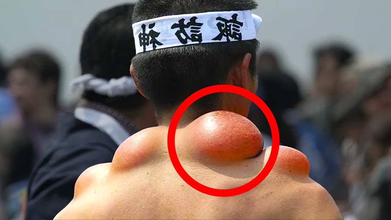 Pessoas Com Habilidades Sobre-Humanas Que Desafiam Explicações