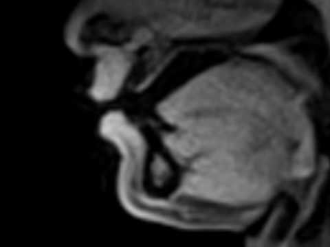 Osteochondrose der Lendenwirbelsäule Temperatur Hüftgelenk in frontaler Projektion