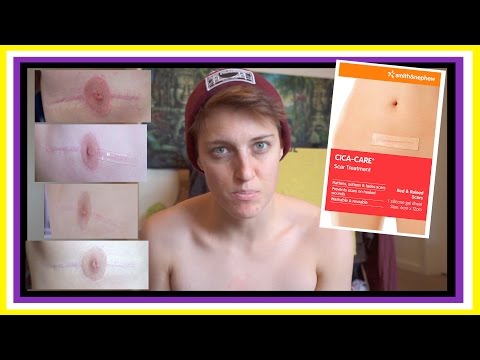 download lagu mp3 mp4 Silikon Sheet, download lagu Silikon Sheet gratis, unduh video klip Silikon Sheet