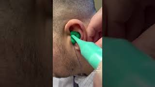 Part Two: Take the impression! #audiologist #earwax #satisfying #asmr #earimpression #audiology