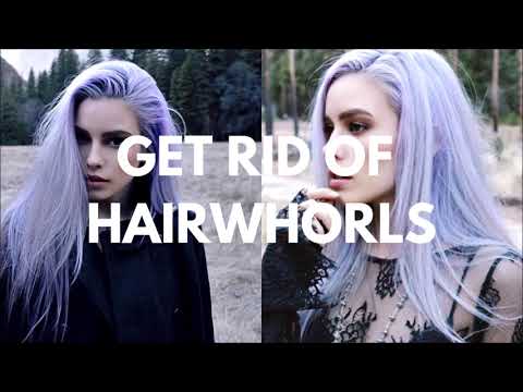 Get Rid of Hairwhorls || Paid Request