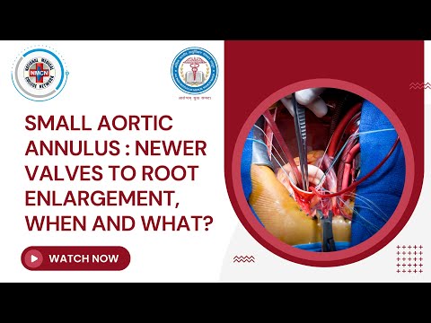 Small aortic annulus : Newer Valves to Root Enlargement, When and What?