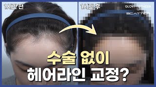 글로비지테라안티에이징의원 \u0026 스타힐링 사용 후기