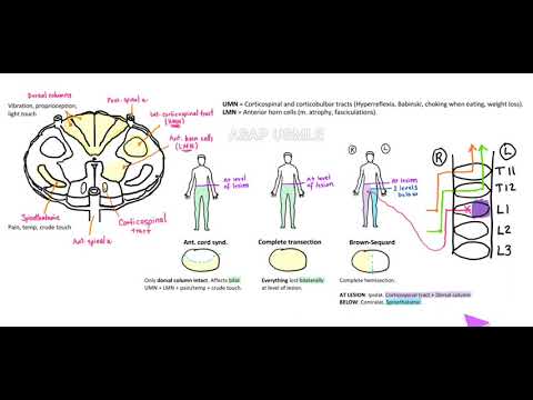 Spinal cord lesions, Spinothalamic tract, UMN and LMN, Brown-Sequard. As easy as it gets!