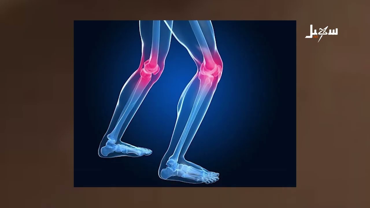 احتكاك المفاصل .. ألم أولي يحاصره الكشف المبكر