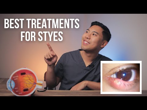 HOW TO GET RID OF STYES FAST: 4 Best Stye Eye Treatments EXPLAINED by an MD
