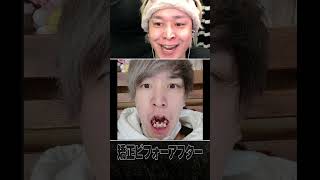 ヘンディー衝撃のビフォーアフター #shorts