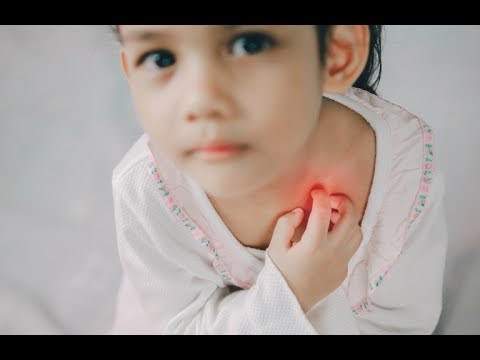 download lagu mp3 mp4 Choroba Morgellonw, download mp3 Choroba Morgellonw free download, download mp3 Choroba Morgellonw