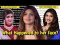 Sreeleela S Face Change SHOCKS Fans Fillers Controversy MBBS Degree Truth EXPOSED