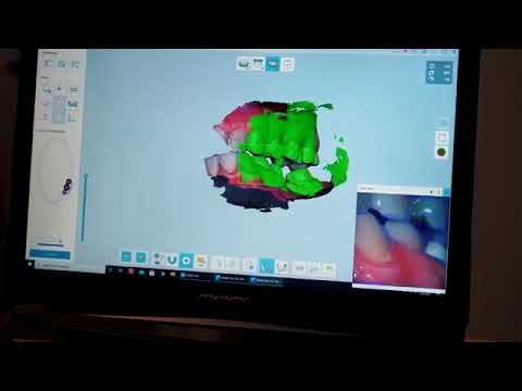 Dentexpert Magic   Amprenta digitala