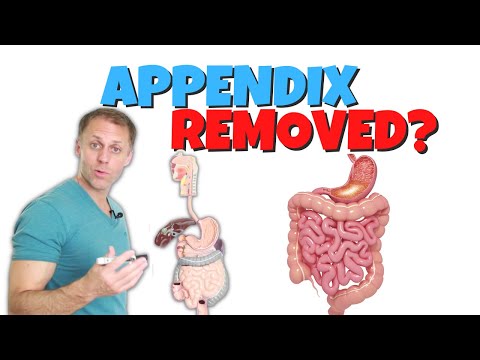 Improving Digestion After Appendix Removal (Appendectomy)