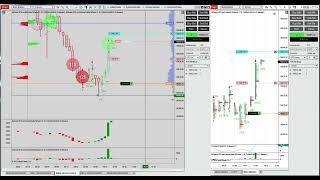 Micro Nasdaq en Futuros - Trading con Order Flow + MZPack | Footprint