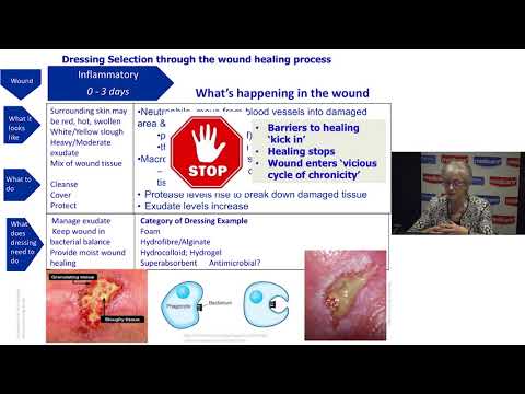 Understanding Wound Dressings Categories and Indications