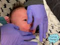 Infant Suck Training