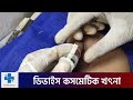 ডিভাইস কসমেটিক খৎনা সুন্নতে খতনা মুস�