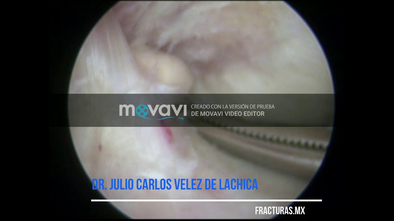 Julio Carlos Vélez De Lachica-53