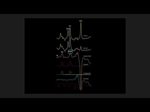 Espectroscopía por resonancia magnética en la esquizofrenia