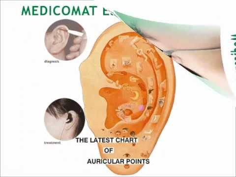 Laser acupuncture device