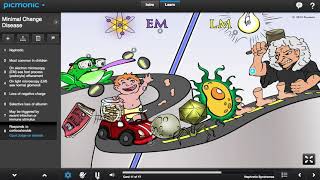 Minimal Change Disease