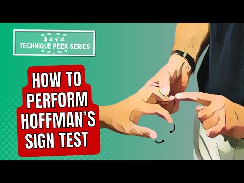 Hoffman's Sign: A Simple Test for Upper Motor Neuron Lesions | Technique Peek Series