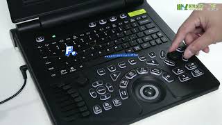 XIANFENG ULTRASOUND MSLCU02: Laptop Color Ultrasound Machine Demo