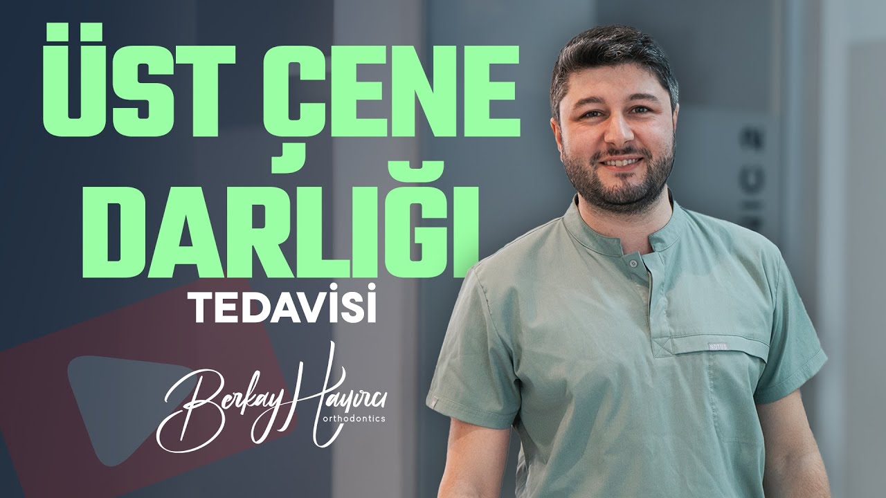 Üst Çene Darlığı Tedavisi