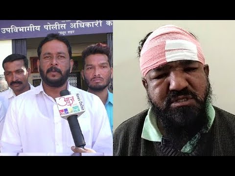 मला झालेल्या मारहाणीला राजकीय रंग देऊ नका- अख्तर मिस्त्री