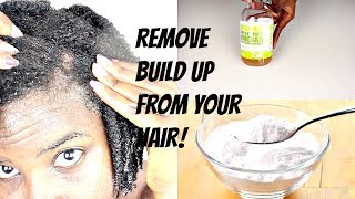 How To Clarify Your Hair And Scalp | Apple Cider Vinegar and Baking Soda